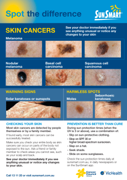 Spot the difference SKIN CANCERS WARNING SIGNS