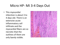 Micro HP- MI 3-4 Days Out