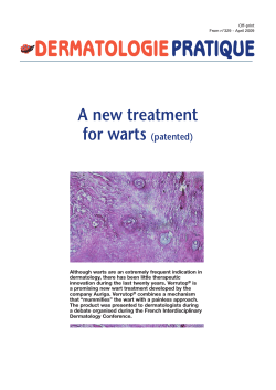 A new treatment for warts (patented)