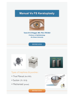 Manual Vs FS Keratoplasty Types of trephines &amp; punches :  •
