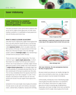 laser iridotomy Laser iridotomy is a surgical procedure used to treat angle-