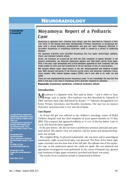 N  Moyamoya: Report of a Pediatric Case