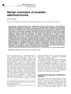 Benign mimickers of prostatic adenocarcinoma John R Srigley