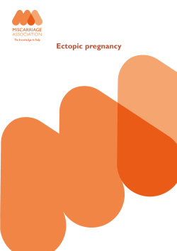 Ectopic pregnancy