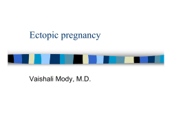 Ectopic pregnancy Vaishali Mody, M.D.