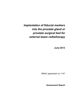 Implantation of fiducial markers into the prostate gland or external beam radiotherapy