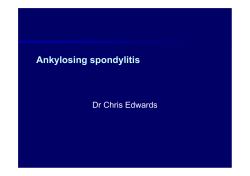 Ankylosing spondylitis Dr Chris Edwards