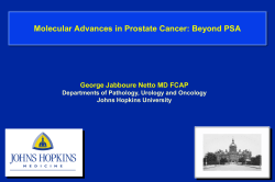 Molecular Advances in Prostate Cancer: Beyond PSA