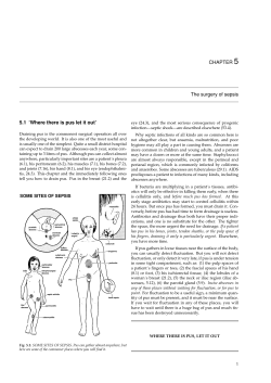 5 CHAPTER The surgery of sepsis