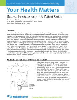 Radical Prostatectomy – A Patient Guide