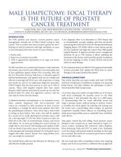 MALE LUMPECTOMY: FOCAL THERAPY IS THE FUTURE OF PROSTATE CANCER TREATMENT