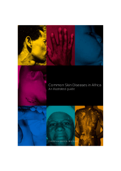 Common Skin Diseases in Africa An illustrated guide