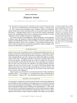 T Alopecia Areata review article