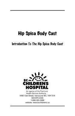 Hip Spica Body Cast Introduction To The Hip Spica Body Cast 604-875-2345