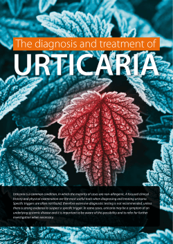 URTICARIA The diagnosis and treatment of