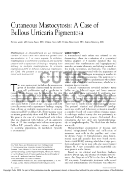 Cutaneous Mastocytosis: A Case of Case Report
