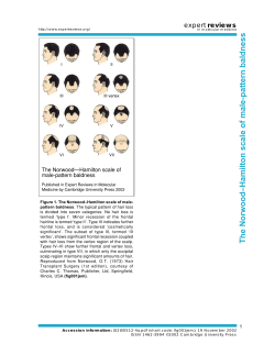expert reviews The Norwood—Hamilton scale of male-pattern baldness