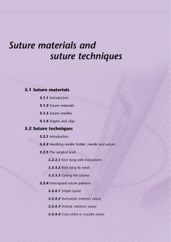 Suture materials and suture techniques 5.1 Suture materials 5.2 Suture techniques