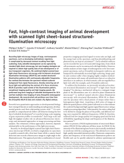 Fast, high-contrast imaging of animal development with scanned light sheet–based structured-