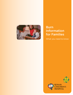 Burn Information for Families What you need to know