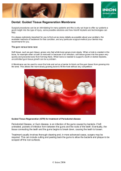 Dental: Guided Tissue Regeneration Membrane