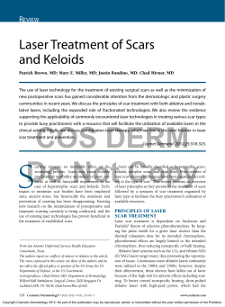 Laser Treatment of Scars and Keloids R