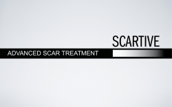 ADVANCED SCAR TREATMENT