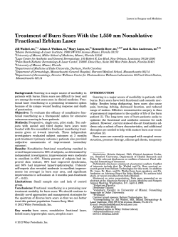 Treatment of Burn Scars With the 1,550 nm Nonablative