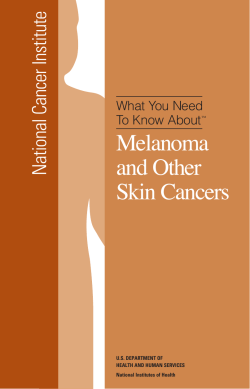 Melanoma and Other Skin Cancers National Cancer Institute