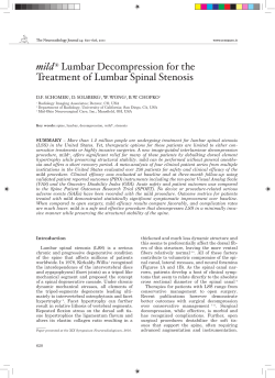 mild Lumbar	Decompression	for	the Treatment	of	Lumbar	Spinal	Stenosis ®