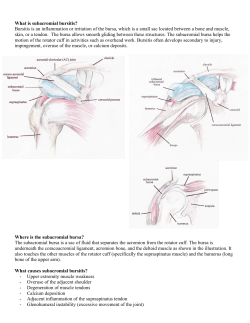 Bursitis is an inflammation or irritation of the bursa, which... What is subacromial bursitis?