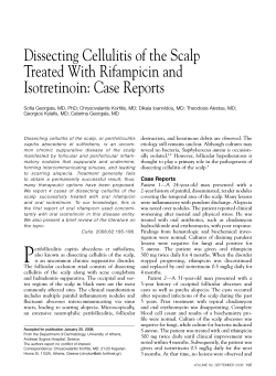 Dissecting Cellulitis of the Scalp Treated With Rifampicin and Isotretinoin: Case Reports