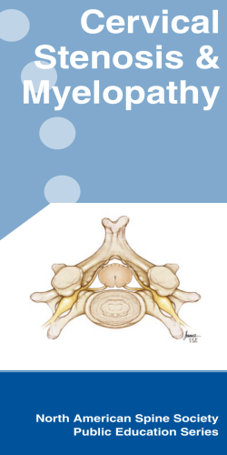 Cervical Stenosis &amp; Myelopathy