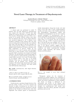 Novel Laser Therapy in Treatment of Onychomycosis
