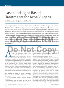 Laser and Light-Based Treatments for Acne Vulgaris R