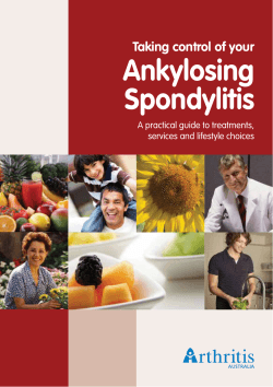 Ankylosing Spondylitis Taking control of your A practical guide to treatments,