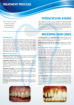 TETRACYCLINE STAINS TREATMENT PROCESS