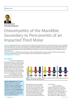 Osteomyelitis of the Mandible Secondary to Pericoronitis of an Impacted Third Molar Oral