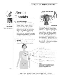 Uterine Fibroids F A