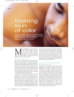 M treating skin of color