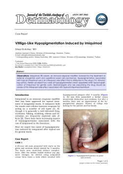 Vitiligo-Like Hypopigmentation Induced by Imiquimod  Case Report Zekayi Kutlubay,