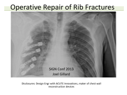 Operative Repair of Rib Fractures SIGN Conf 2013 Joel Gillard
