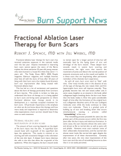 Fractional Ablation Laser