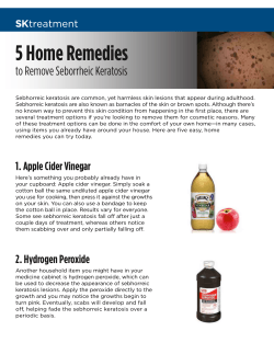 5 Home Remedies to Remove Seborrheic Keratosis