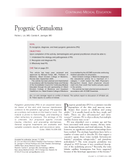 Pyogenic Granuloma C M E