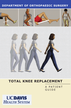 TOTAL KNEE REPLACEMENT DEPARTMENT OF ORTHOPAEDIC SURGERY G U I D E