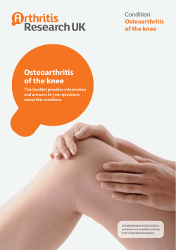 Osteoarthritis of the knee Condition This booklet provides information