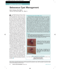 Sebaceous Cyst Management A Mia S. Pacheco, RN, CWCN