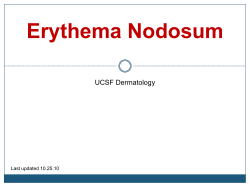 Erythema Nodosum UCSF Dermatology Last updated 10.25.10
