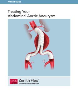 Treating Your Abdominal Aortic Aneurysm PATIENT GUIDE